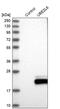 Ubiquitin Conjugating Enzyme E2 L6 antibody, PA5-51895, Invitrogen Antibodies, Western Blot image 