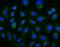 UDP Glucuronosyltransferase Family 1 Member A3 antibody, A04062, Boster Biological Technology, Immunofluorescence image 
