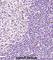 Bruton Tyrosine Kinase antibody, abx027458, Abbexa, Western Blot image 
