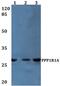 Protein Phosphatase 1 Regulatory Inhibitor Subunit 1A antibody, PA5-37201, Invitrogen Antibodies, Western Blot image 