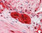 ZEB2 antibody, ARP39141_P050, Aviva Systems Biology, Immunohistochemistry paraffin image 