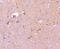 P21 (RAC1) Activated Kinase 3 antibody, NBP2-67484, Novus Biologicals, Immunohistochemistry paraffin image 