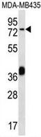 Carboxyl Ester Lipase antibody, AP50851PU-N, Origene, Western Blot image 