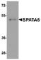 Spermatogenesis Associated 6 antibody, orb75685, Biorbyt, Western Blot image 
