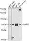 Aspartyl-tRNA synthetase, mitochondrial antibody, 19-477, ProSci, Western Blot image 