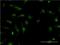 Heparin Binding Growth Factor antibody, H00003068-M09, Novus Biologicals, Immunocytochemistry image 