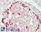 Tumor Susceptibility 101 antibody, LS-B13375, Lifespan Biosciences, Immunohistochemistry paraffin image 
