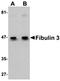 EGF Containing Fibulin Extracellular Matrix Protein 1 antibody, orb75215, Biorbyt, Western Blot image 