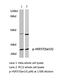 Heat Shock Protein Family B (Small) Member 1 antibody, LS-C175867, Lifespan Biosciences, Western Blot image 