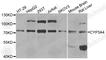 Cytochrome P450 Family 3 Subfamily A Member 4 antibody, A2544, ABclonal Technology, Western Blot image 
