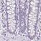 p24 antibody, NBP2-34031, Novus Biologicals, Immunohistochemistry paraffin image 