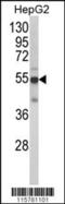 Cytochrome P450 Family 2 Subfamily J Member 2 antibody, 62-918, ProSci, Western Blot image 