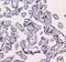 CD209 Molecule antibody, A01025-2, Boster Biological Technology, Immunohistochemistry paraffin image 