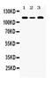 Helicase Like Transcription Factor antibody, PA5-79371, Invitrogen Antibodies, Western Blot image 