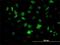 Hematopoietically-expressed homeobox protein HHEX antibody, H00003087-M02, Novus Biologicals, Immunofluorescence image 
