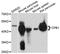 Carboxypeptidase B1 antibody, LS-B15588, Lifespan Biosciences, Western Blot image 
