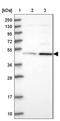 Spermatid Associated antibody, NBP1-86592, Novus Biologicals, Western Blot image 