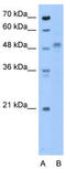 Zona pellucida sperm-binding protein 4 antibody, TA338463, Origene, Western Blot image 