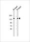 Homeodomain Interacting Protein Kinase 3 antibody, 62-973, ProSci, Western Blot image 