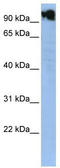 Zinc Finger Protein Y-Linked antibody, TA343386, Origene, Western Blot image 