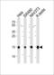Ubiquitin Conjugating Enzyme E2 D2 antibody, MBS9213327, MyBioSource, Western Blot image 