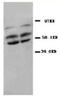 Protein Phosphatase 2 Catalytic Subunit Alpha antibody, AP23366PU-N, Origene, Western Blot image 