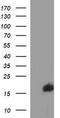 SIVA1 Apoptosis Inducing Factor antibody, M05419, Boster Biological Technology, Western Blot image 