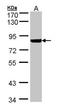 Phosphofructokinase, Liver Type antibody, orb73873, Biorbyt, Western Blot image 