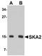 Spindle And Kinetochore Associated Complex Subunit 2 antibody, orb75277, Biorbyt, Western Blot image 