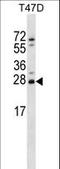 Zinc Finger Matrin-Type 2 antibody, LS-C160795, Lifespan Biosciences, Western Blot image 