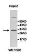 Zinc Finger Matrin-Type 3 antibody, orb77932, Biorbyt, Western Blot image 