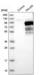 Palmdelphin antibody, PA5-53678, Invitrogen Antibodies, Western Blot image 