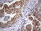 Keratin 24 antibody, M13429, Boster Biological Technology, Immunohistochemistry paraffin image 