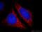 ATP Binding Cassette Subfamily B Member 9 antibody, 11066-1-AP, Proteintech Group, Immunofluorescence image 