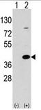 Laforin antibody, AP11437PU-N, Origene, Western Blot image 