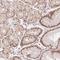 DEK Proto-Oncogene antibody, HPA057799, Atlas Antibodies, Immunohistochemistry frozen image 