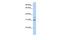 Potassium Channel Regulator antibody, GTX47618, GeneTex, Western Blot image 