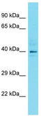 Lic3 antibody, TA335575, Origene, Western Blot image 