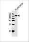 ALPI antibody, A06115-1, Boster Biological Technology, Western Blot image 