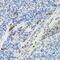 Galactose-1-Phosphate Uridylyltransferase antibody, GTX54159, GeneTex, Immunohistochemistry paraffin image 
