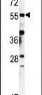 FKBP-63 antibody, PA5-14279, Invitrogen Antibodies, Western Blot image 