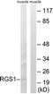 Regulator Of G Protein Signaling 1 antibody, LS-B7701, Lifespan Biosciences, Western Blot image 