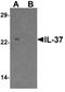 Interleukin-1 family member 7 antibody, A03607-1, Boster Biological Technology, Western Blot image 