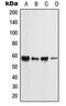 Phosphatidylinositol Glycan Anchor Biosynthesis Class W antibody, LS-C353671, Lifespan Biosciences, Western Blot image 