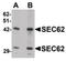 SEC62 Homolog, Preprotein Translocation Factor antibody, LS-B9568, Lifespan Biosciences, Western Blot image 