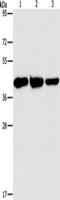 Aspartate aminotransferase, cytoplasmic antibody, TA349690, Origene, Western Blot image 