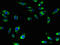 Sodium/glucose cotransporter 5 antibody, orb25728, Biorbyt, Immunofluorescence image 