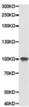 ATPase Sarcoplasmic/Endoplasmic Reticulum Ca2+ Transporting 2 antibody, TA323129, Origene, Western Blot image 