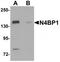 NEDD4 Binding Protein 1 antibody, TA319783, Origene, Western Blot image 