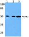 Pantothenate Kinase 2 antibody, PA5-75678, Invitrogen Antibodies, Western Blot image 